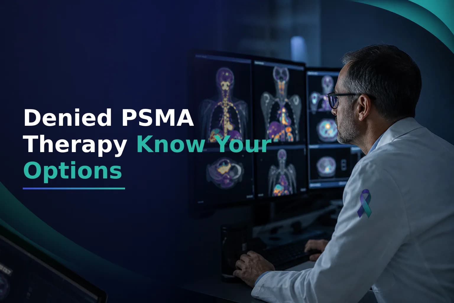 Denied Lu-177 PSMA Therapy? Understanding Eligibility Criteria and How to Get a Second Opinion from a Specialist