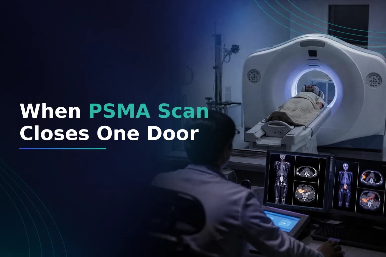 Your PSMA PET Scan Came Back Negative or Very Faint โ What to Do When Lu-177 PSMA Isn't an Option