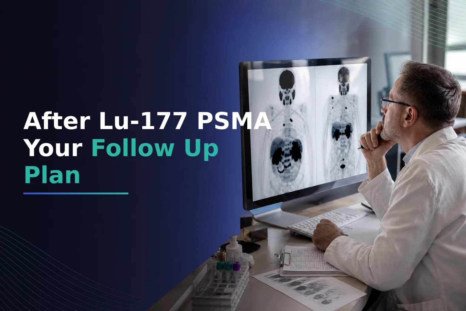 After Your Lu-177 PSMA Cycles: What to Monitor, When to Decide About Next Steps, and How to Get a Follow-Up Care Plan